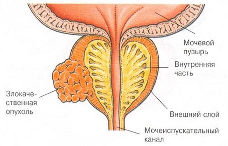 1410502485_0.jpg