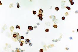 Enterovirus-Infection.jpg